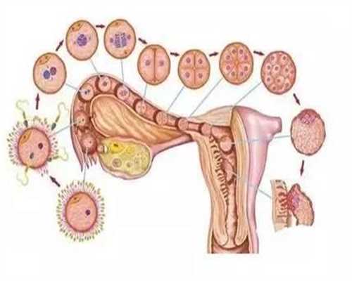 你真的了解多囊卵巢综合征吗？_代孕有哪些风险