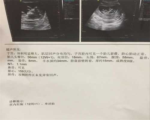 广州借卵包男孩：子宫内膜厚可以代孕吗