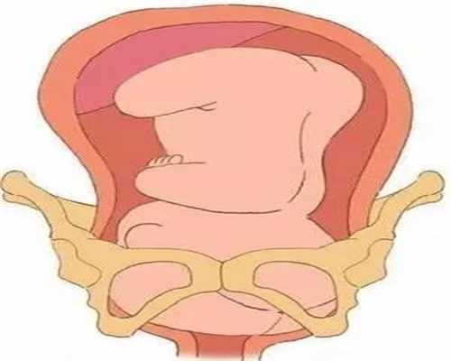 代孕法律问题：女性输卵管为什么会发炎输卵管