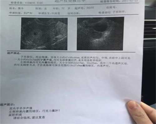 广州南方医院供卵_孕早期，代孕若有这3种症状，