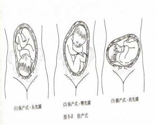 北京有代生宝宝_“第三代辅助生殖技术”让更多