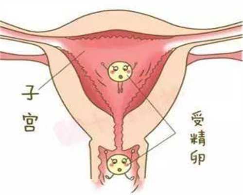 南京代孕医院_如何预防孕早期出血
