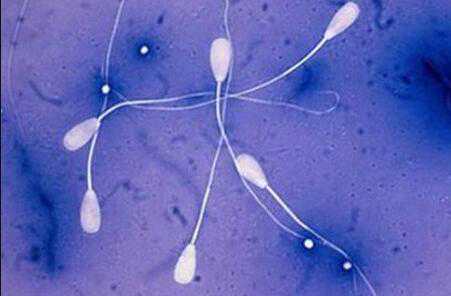 助孕男性精子异常应该怎么做试管婴儿